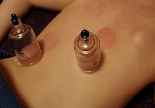 Hijama Helps in Detoxification