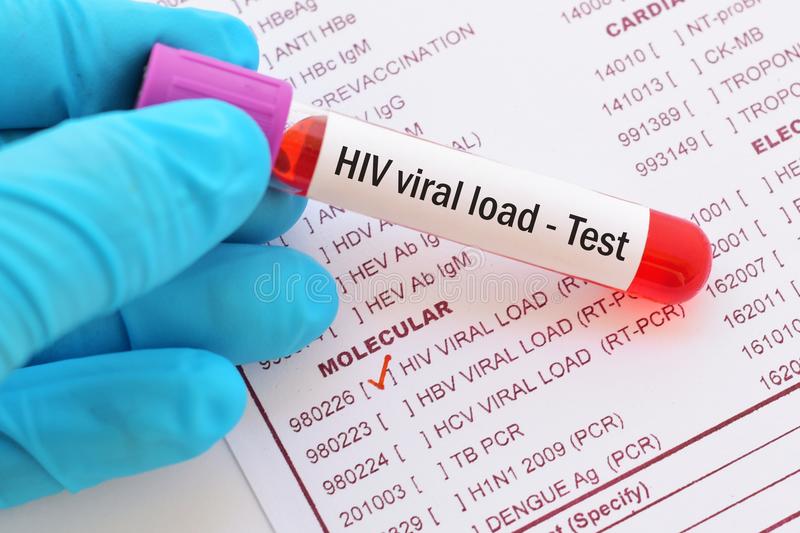 Our Goal Undetectable Viral Load Living with HIV in the Philippines