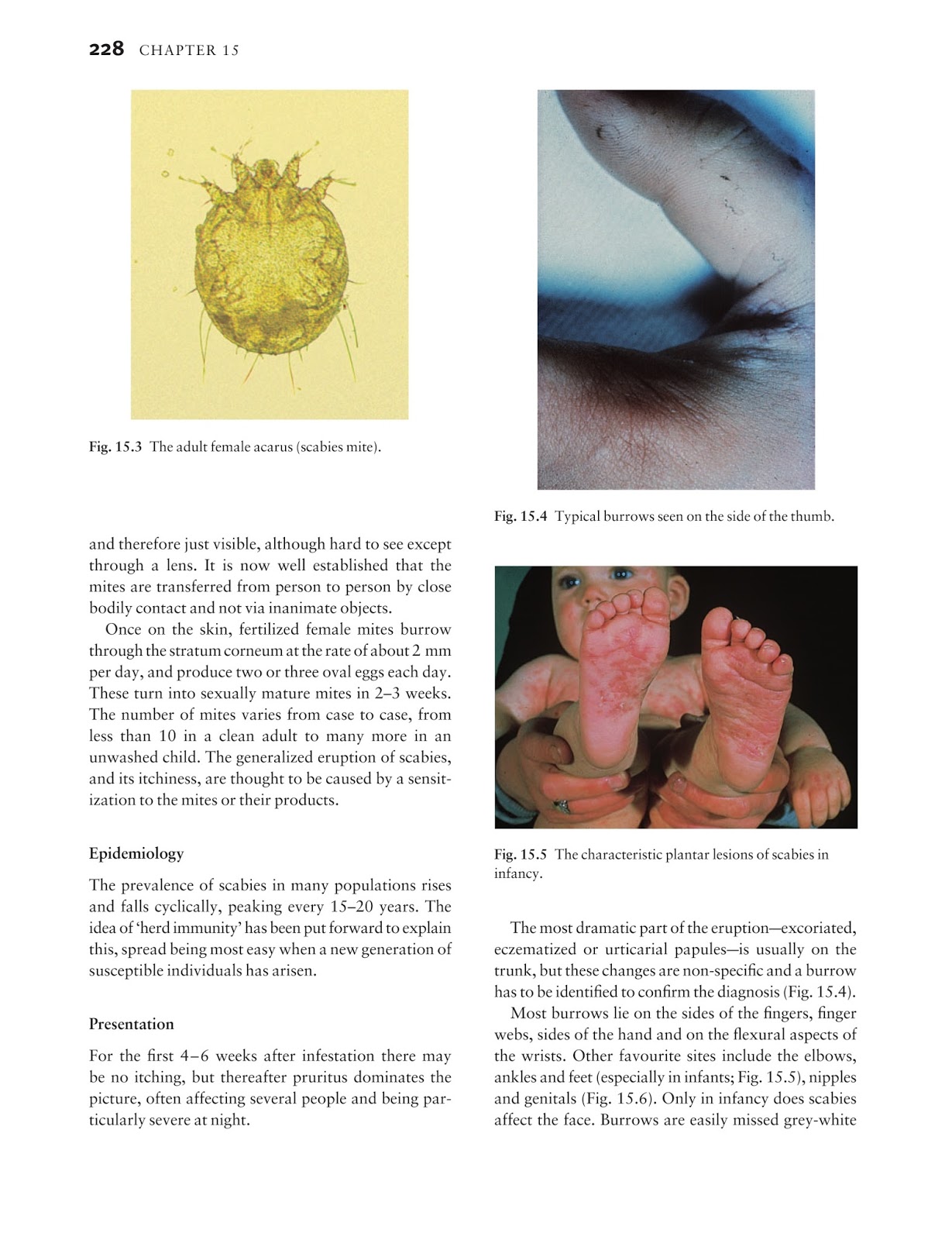 Medicine by Sfakianakis G. Alexandros: Skin disease in perspective 4