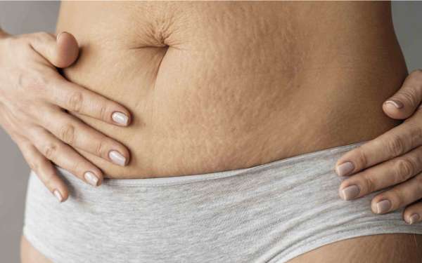 5 Changes That Happen to the Skin During Pregnancy