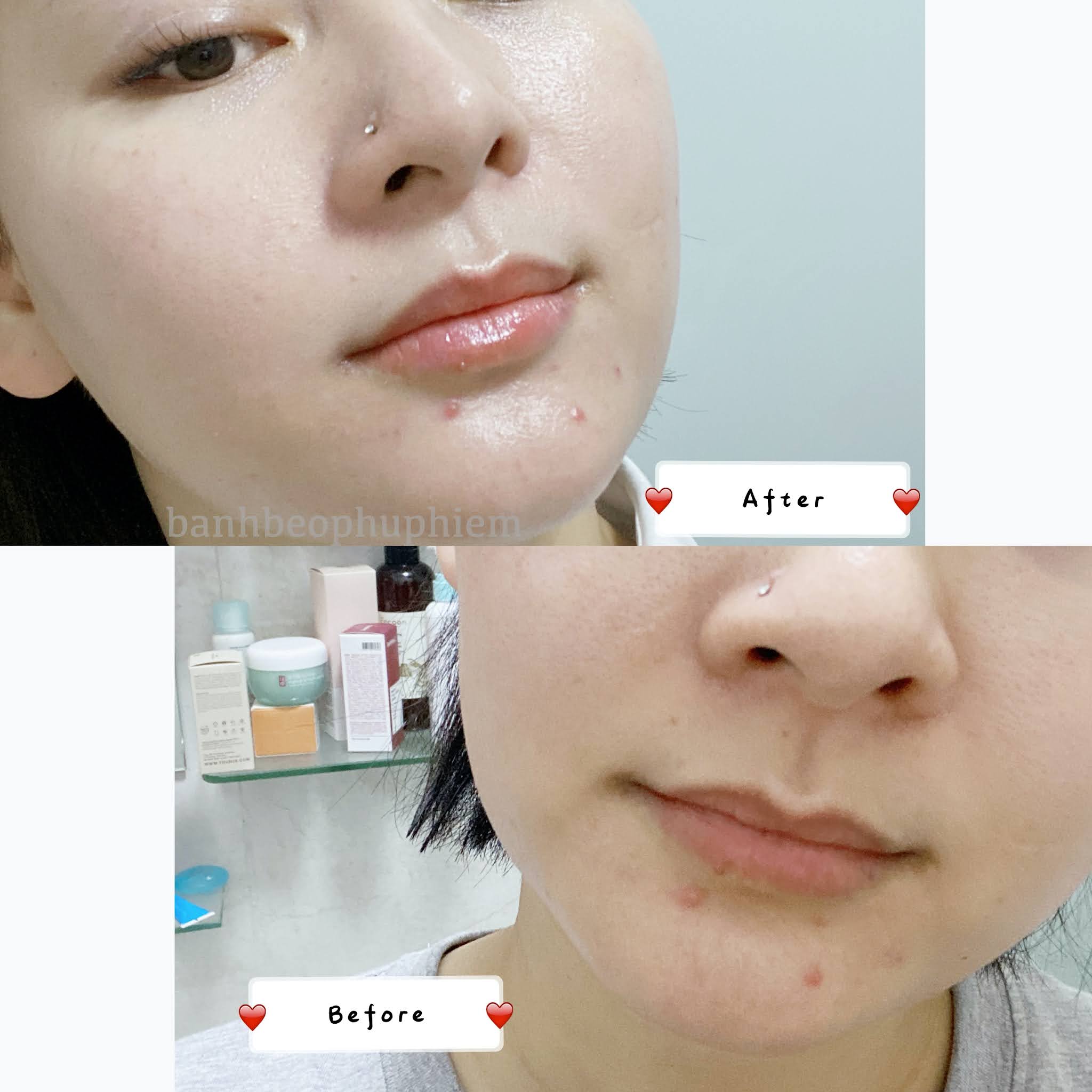 255 REVIEW COSRX Refresh AHA BHA Vitamin C Lip Plumper Bánh Bèo Phù