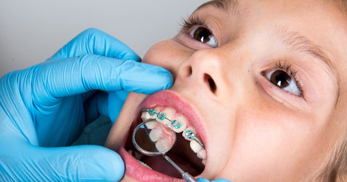 Relation Of Obstructive Sleep Apnea And Orthodontist In LA