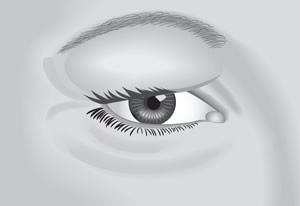 Causas, síntomas y tratamiento de la inflamación ocular