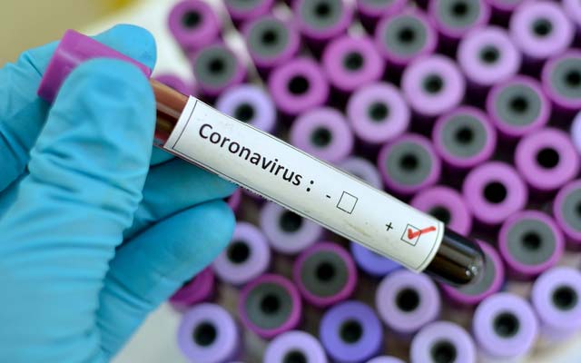 Itabuna tem primeiro caso confirmado de novo coronavírus; 31º na Bahia