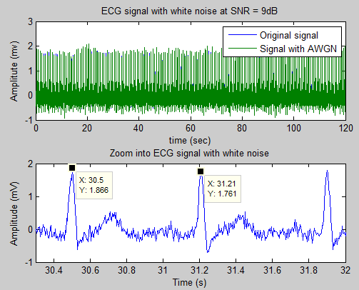 Biomedical Signal and Image Processing projects using Matlab and ...