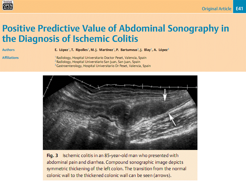 Essay On Ischemic Colitis