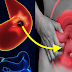 Stomach Ulcer Signs You Should not Ignore