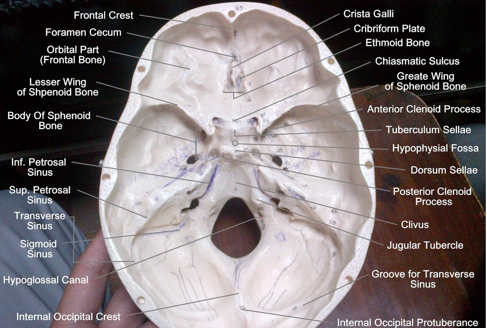 Anatomy Made Easy Base Of The Skull