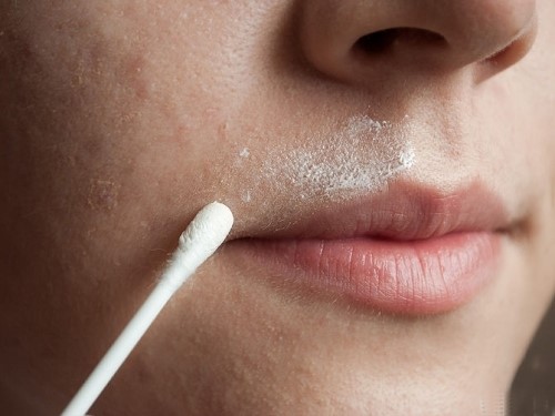 Bí quyết giúp bạn gái tẩy sạch ria mép đơn giản nhanh chóng