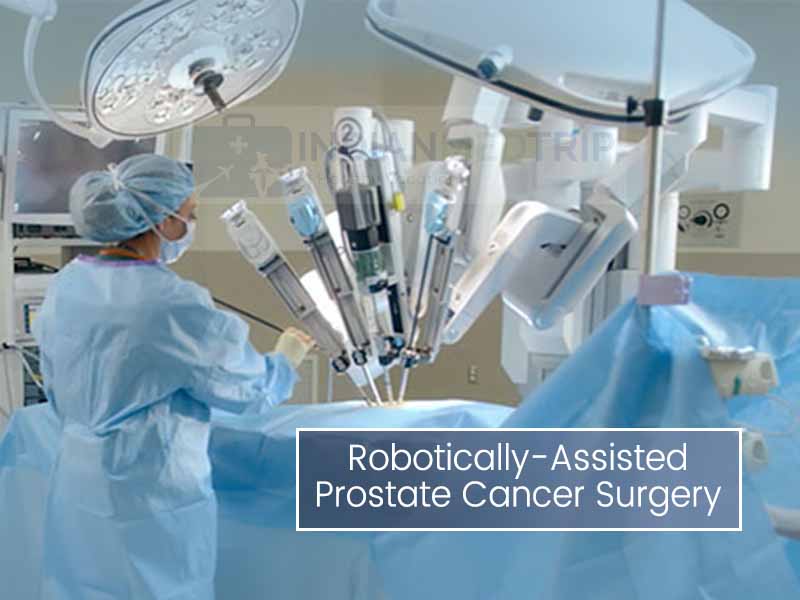 RoboticallyAssisted Prostate Cancer Surgery in India Healthcare In India