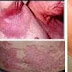 Nama Obat Eksim Gatal Gatal Pada Lengan