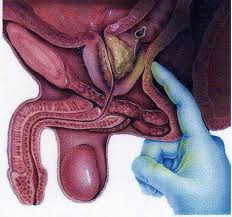 acute prostatitis treatment guidelines 2018