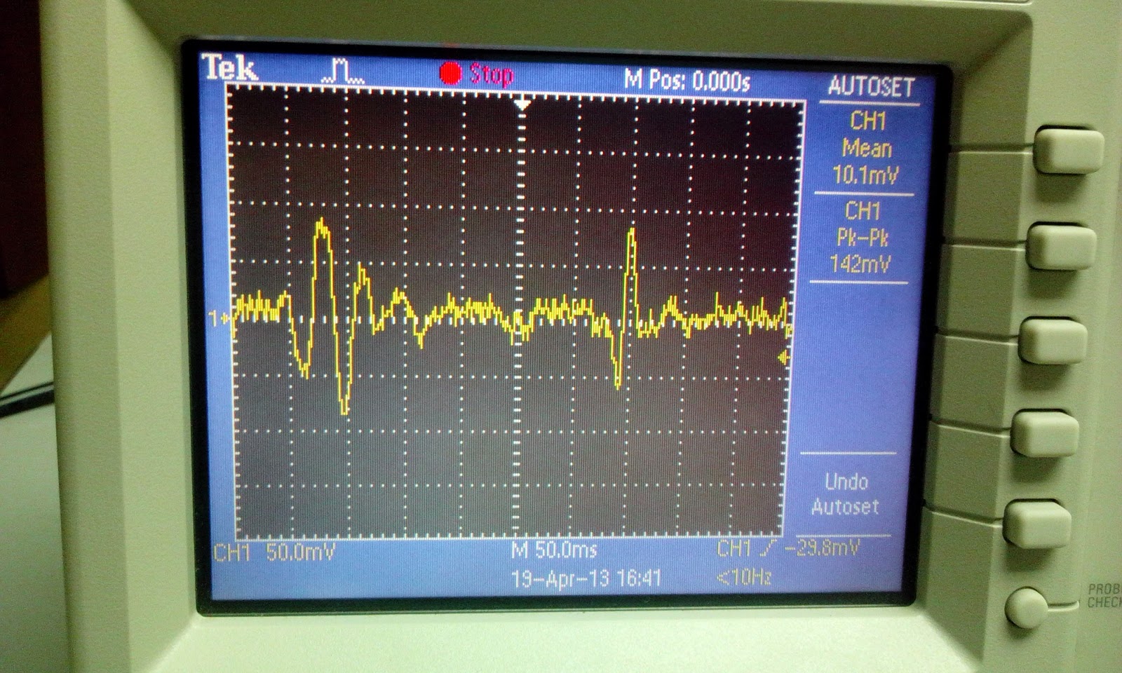 The Development Of Low Cost Electronic Stethoscope fyp_week 7 The