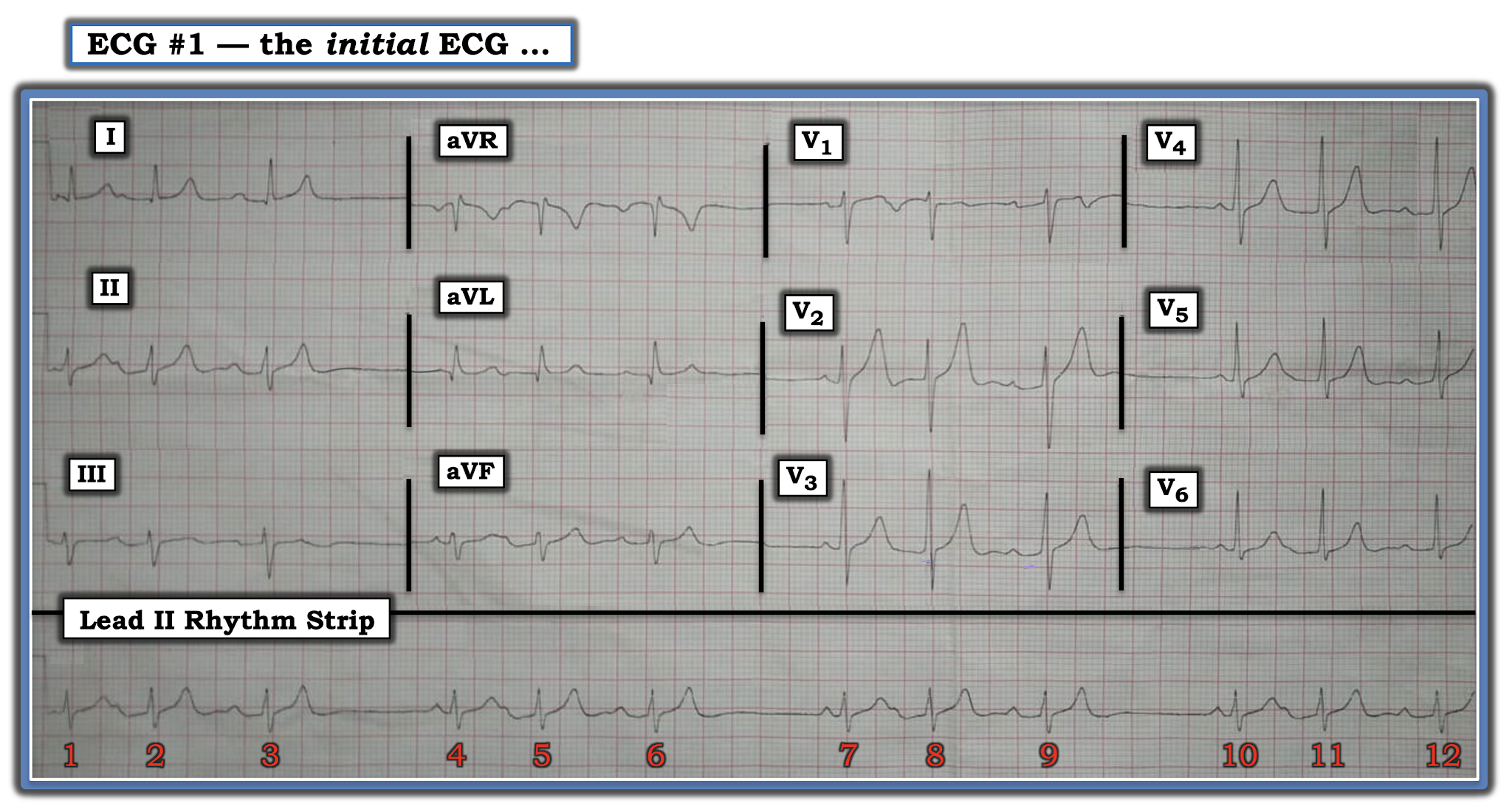 атлас экг хэмптон. показатели норм и патологии на экг. ответы кардиограмма. показатели норм и патологии на экг. клинические ситуации ".