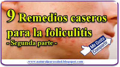 9 Remedios caseros para la foliculitis - Segunda parte -