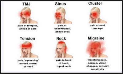 Remove A Headache Without Any Medicine Remove A Headache Without