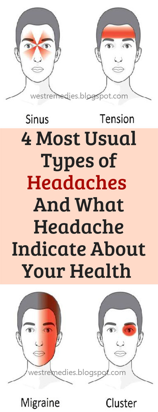 Four Usual Types of Headaches , What Headache Indicate About Your ...