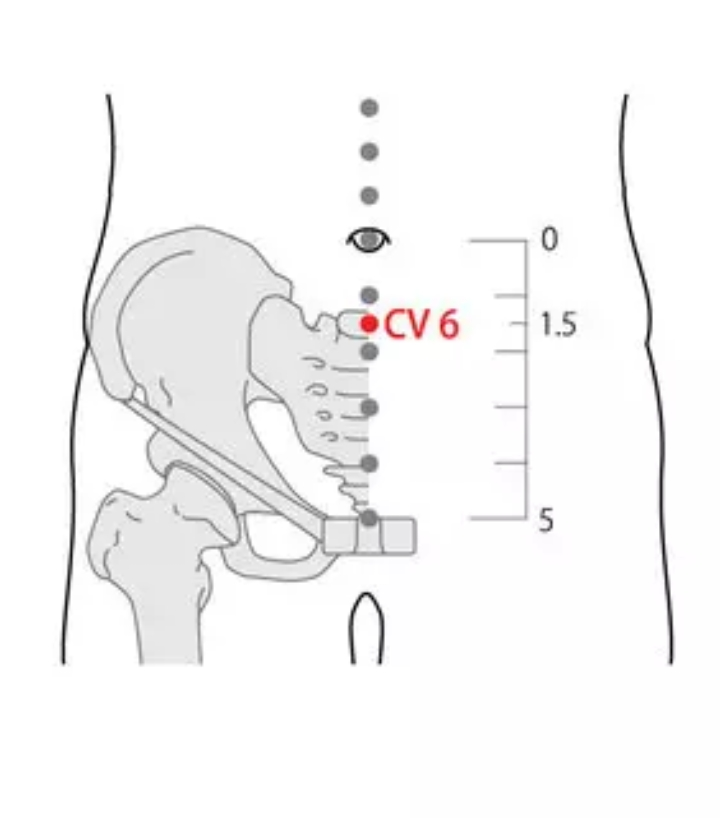 SaroEpic Acupuncture Top 5 acu points and 5 things that can help you