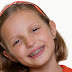 Niềng răng trẻ em khắc phục khuyết điểm gì?