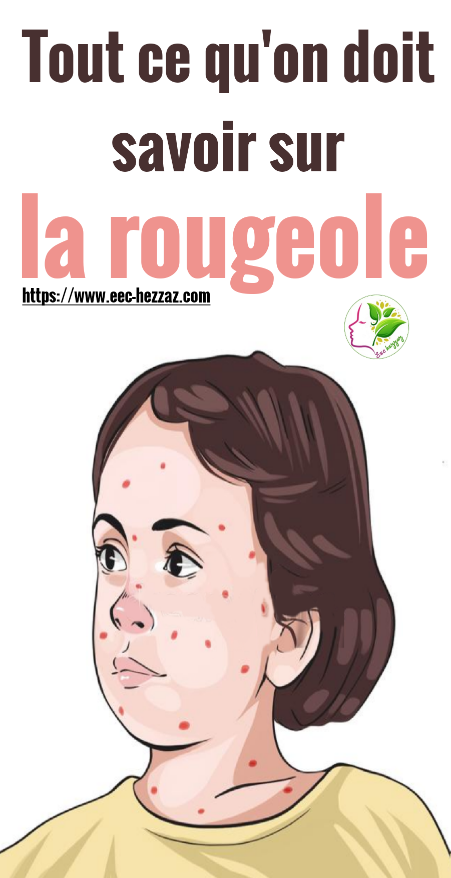 Tout ce qu'on doit savoir sur la rougeole