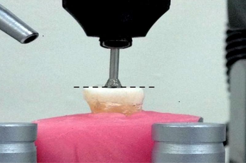 PDF Bonding values of two contemporary ceramic inlay materials to