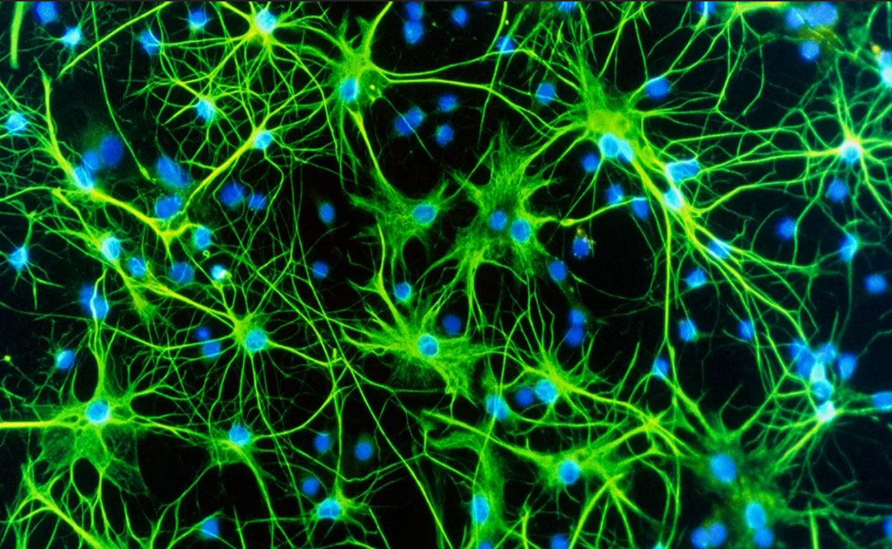 Астроциты мозга. Астроциты клетки. Нейрон Пуанкаре микрофотография. Астроциты микроскоп. Нейронная клетка.