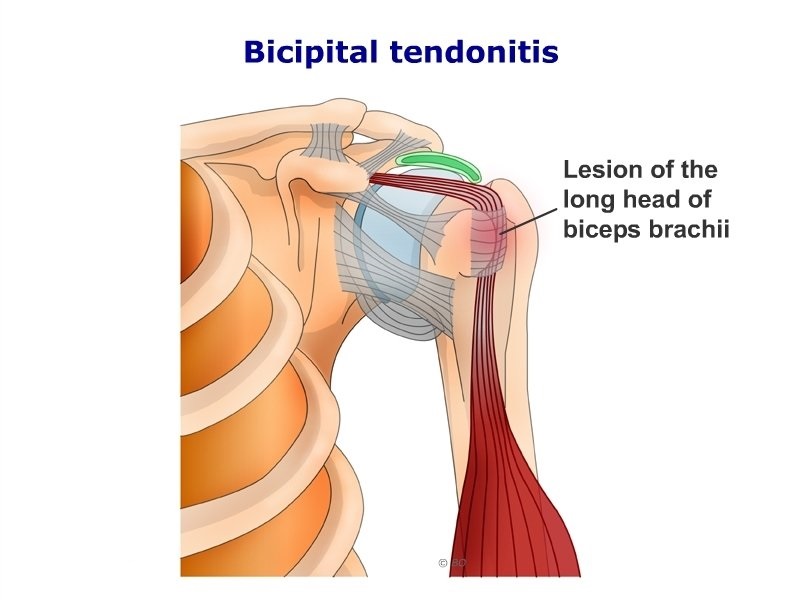 M biceps brachii Caput longum