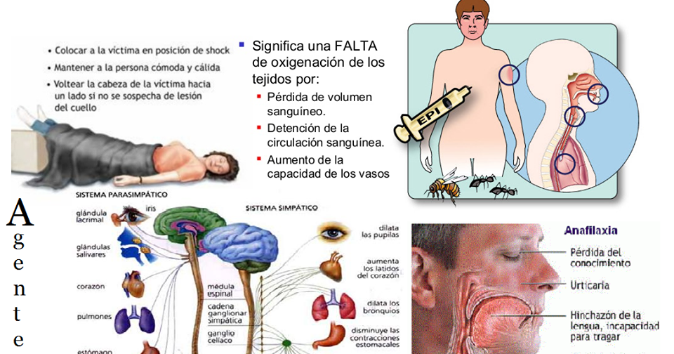 Agentes de Salud Shock (Choque)