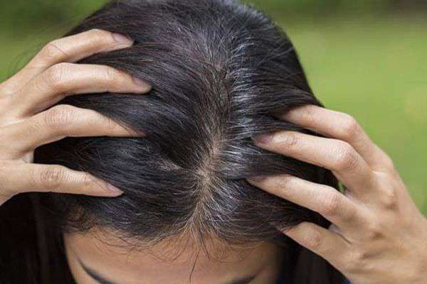 These are the special reasons behind premature white hair Funny Jokes These are the special reasons behind premature white hair Funny Jokes