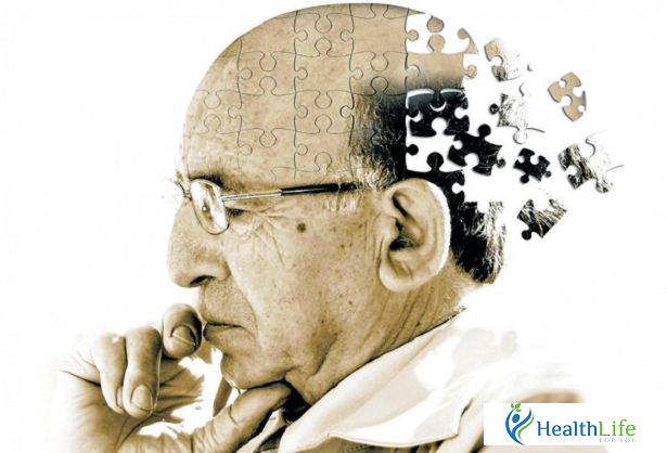 Memory Impairment In The Elderly - Causes And Precautions