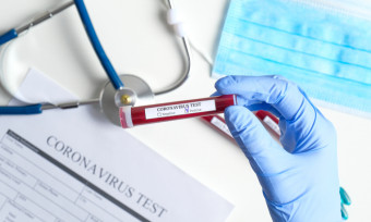 Još dva slučaja koronavirusa u Plavu
