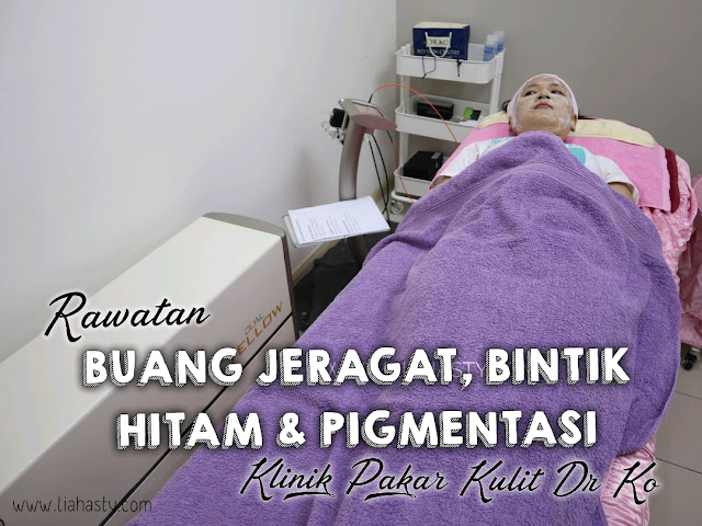 Rawatan Buang Jeragat, Bintik Hitam & Pigmentasi di Klinik Pakar Kulit Dr. Ko Juru