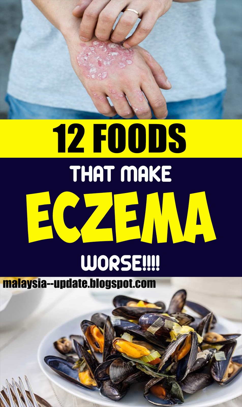 12 Foods that Make Eczema Worse