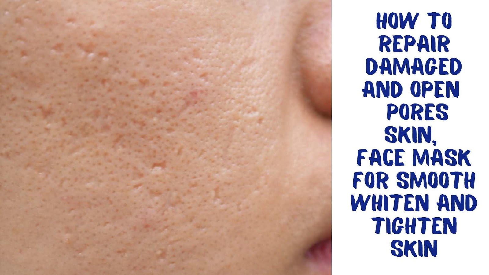 How to Repair Damaged and Open Pores Skin, Face Mask For Smooth Whiten