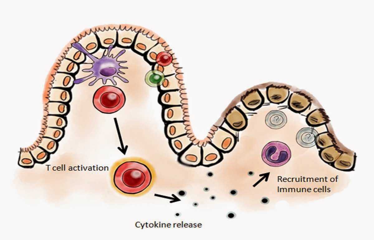 Pubmed gastroschisis image