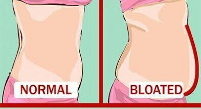 what is stomach bloating