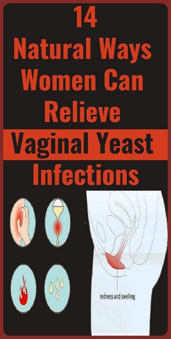 14 Natural Treatments For a Vaginal Yeast Infection