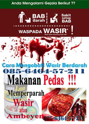 obat wasir luar eksternal bagus obat wasir luar eksternal bagus
