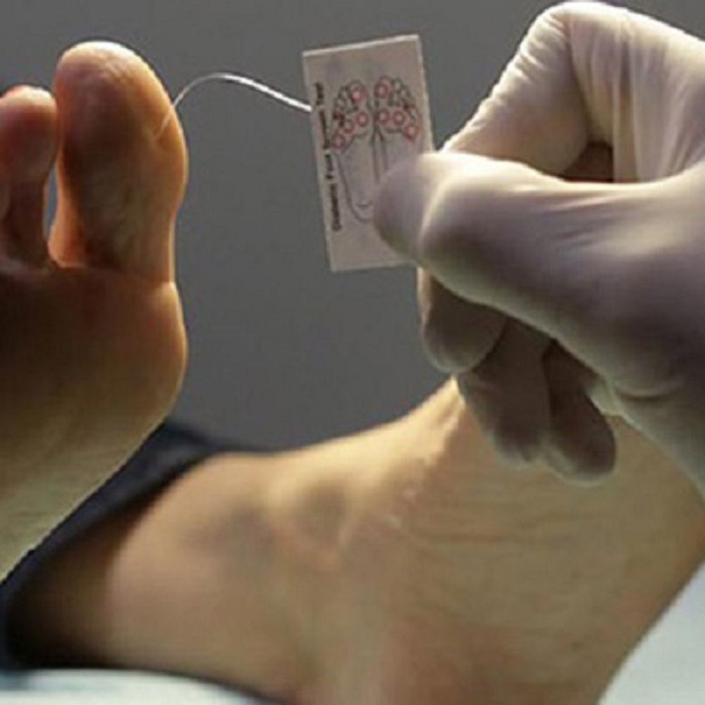 Atlas Biomechanics Semmes Weinstein Monofilament to Test for Loss of