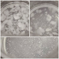 gel hialurónico