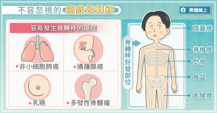 癌症骨轉移