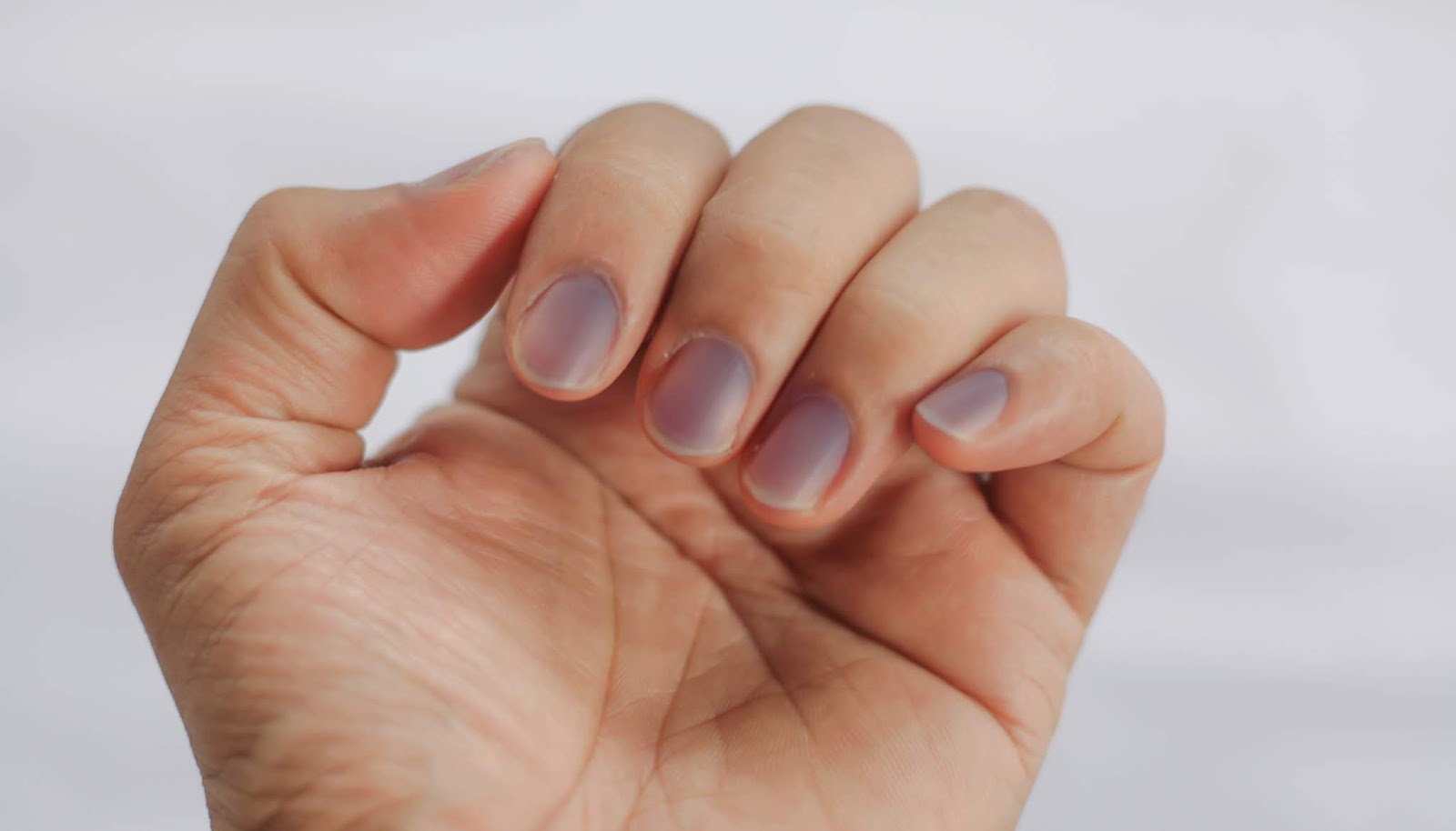 الأظافر وصحة الجسم !! تعرف علي أهم العلامات المرضية