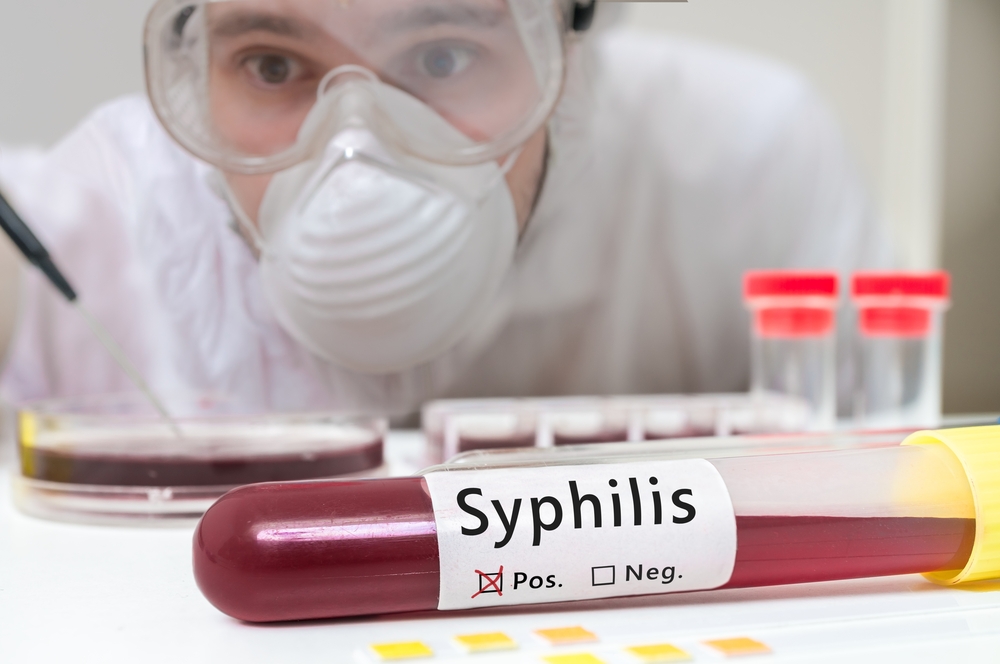 Penyakit Sipilis (Sifilis, Raja Singa): Obat, Ciri, Gejala, Cara Pengobatan