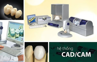 Răng sứ Venus được sản xuất bằng hệ thống CAD?