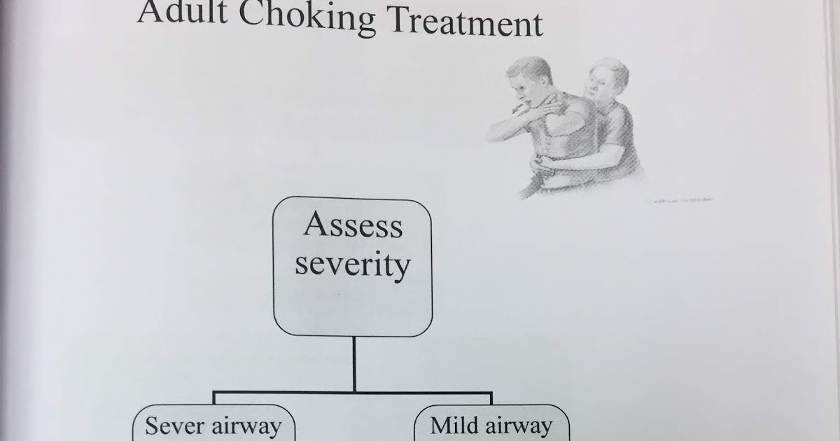 ADULT CHOKING TREATMENT