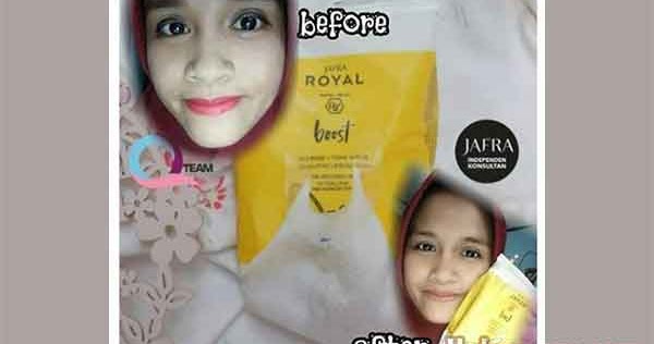 31++ Contoh copywriting produk skincare ideas in 2021 