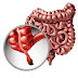 Top 5 Functions of Appendix