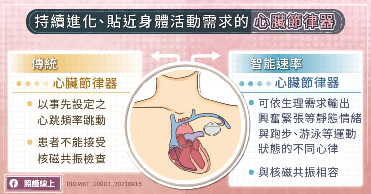 持續進化、貼近身體活動需求的心臟節律器