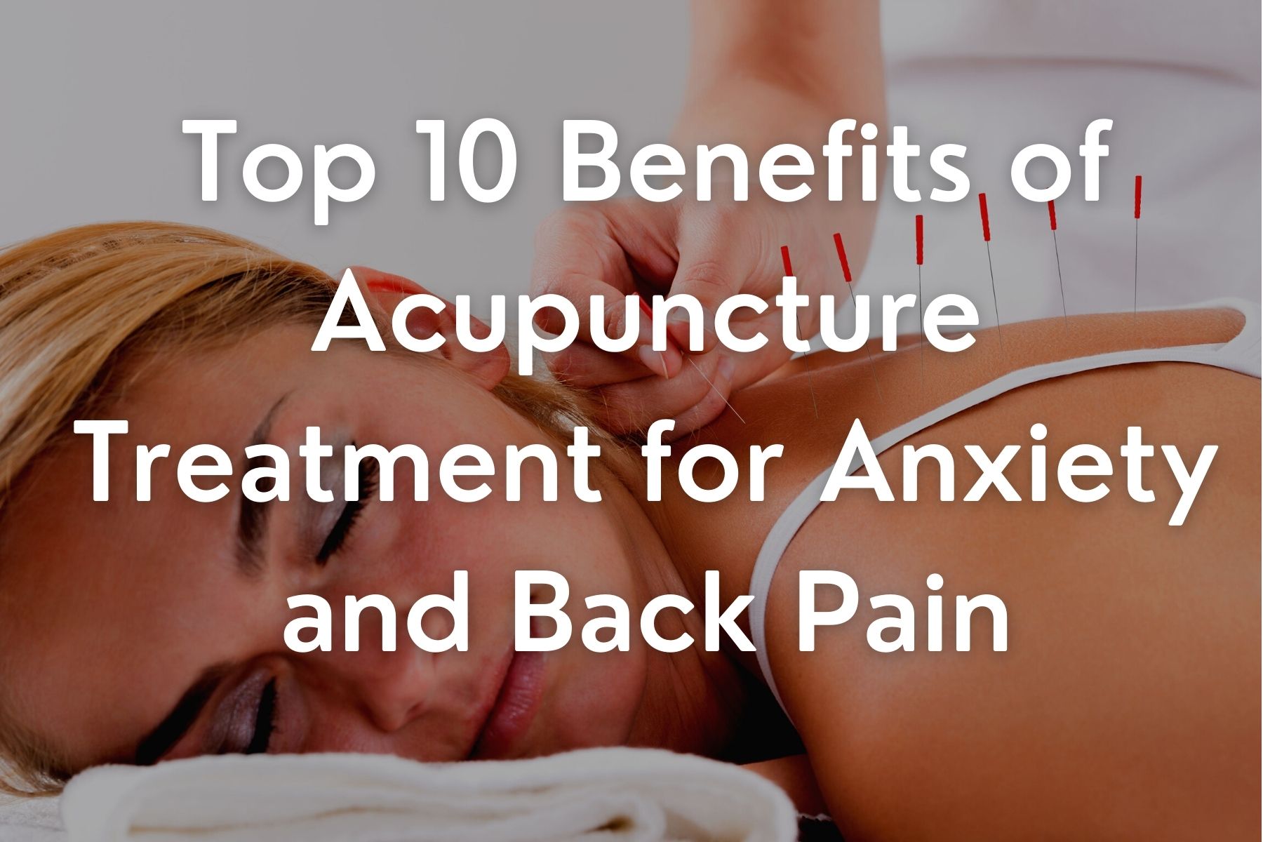 Top 10 Benefits of Acupuncture Treatment for Anxiety and Back Pain