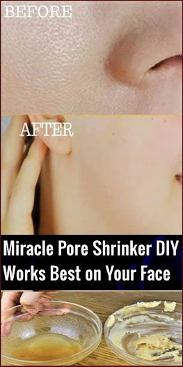 Miracle Pore Shrinker DIY . It’s Works Best on Your Face